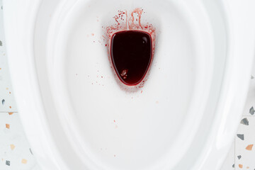 Blood from hemorrhoids or menstruation in the flushed. Clean flush toilet after the stools that are...