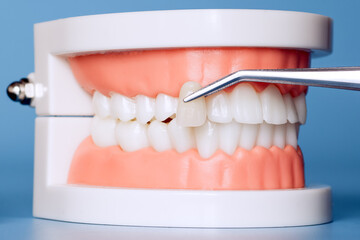 dental veneer being matched to teeth on a plastic dental model, used for cosmetic dentistry and tooth restoration