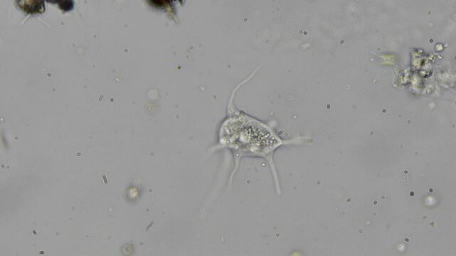 Fast motion microscopy showing amoeba movement in a single drop of water, revealing hidden biological activity.