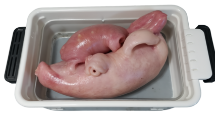 Transplanting pig kidney into human could revolutionize organ donation and save countless lives