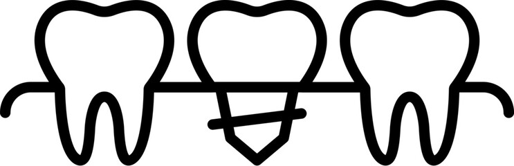 Minimalistic Icon of Dental Implant for Graphics, Concept, Apps