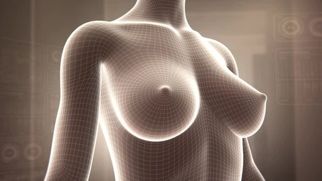 Female breast enhancement, breast augmentation, making sagging breasts fuller and firmer, plastic surgery, silicone filler surgery to improve size and shape, 3D style wireframe human body animation.