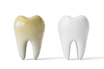 Comparison of stained and healthy white teeth on clean background highlighting dental hygiene and whitening effect. 3D Rendering. 3D Rendering