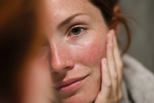 Redhead Woman's Face with Rosacea and Freckles, Natural Skin, Looking at her Reflection in a Mirror, Touch - Powered by Adobe