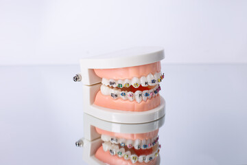 Dentist's work in dental office, showing jaw with braces. Orthodontic treatment, dental care concept