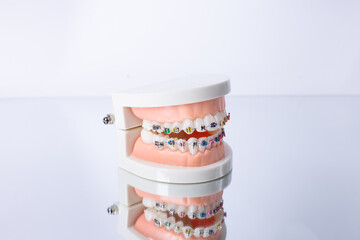 Dentist's work in dental office, showing jaw with braces. Orthodontic treatment, dental care concept