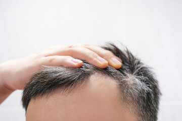 Fototapeta premium Man touching her hair close up on white background, hair loss concept.