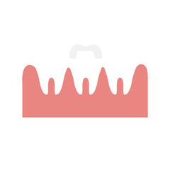 dental crown
