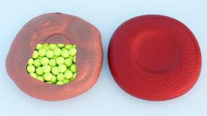 A 3d rendering of red blood cell reveals an internal infestation of numerous yellow oval-shaped structures. The presence of the malaria parasite in its merozoite or trophozoite stage. 