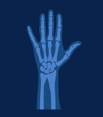 Flat illustration of x-ray of human healthy hand. Scientific cartoon simple picture.