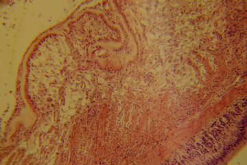 Cross section of earthworm clitellum showing glandular