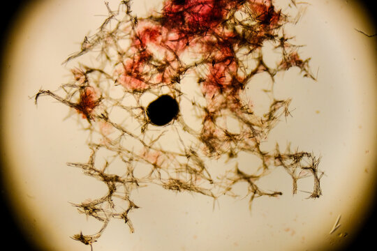 Spongilla skeleton showing spicules network and structure