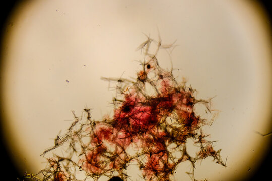 Spongilla skeleton showing spicules network and structure