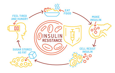 Insulin resistance infographic showing causes and effects.