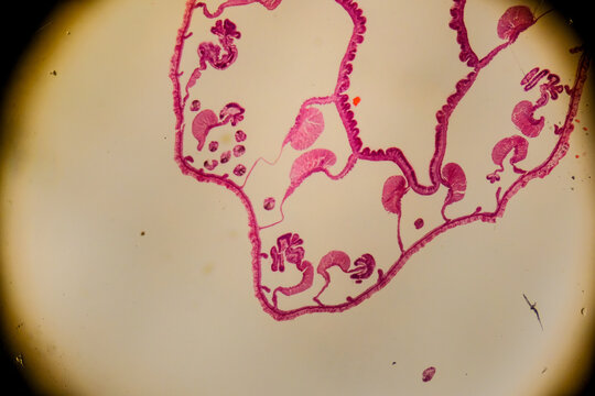 Metridium sea anemone section showing gastrovascular cavity and mesenter