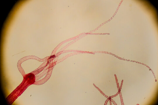 Hydra polyp with visible budding and tentacle extension under microsc