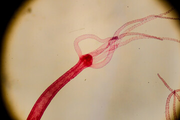 Hydra polyp with visible budding and tentacle extension under microsc