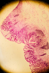 Human stomach tissue under microscope showing gastric glands and muc