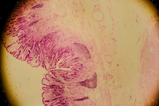 Human stomach tissue under microscope showing gastric glands and muc