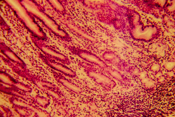 Human stomach tissue under microscope showing gastric glands and muc