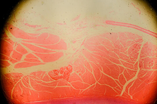 Human larynx under microscope showing vocal cords and cartilage l