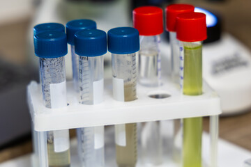 Dropping liquid on glass slide