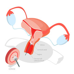 3D Isometric Flat  Illustration of Pap Test, Process Of Conducting A Pap Testing To Detect Abnormal Cells In The Cervix