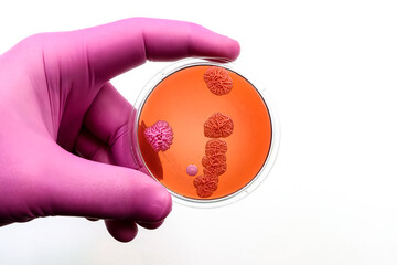 Doctor's or scientist's hand with a microbiological culture dish with colonies of bacteria and yeast	