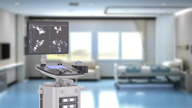 3d rendering ultrasound machine in hospital room 4k footage