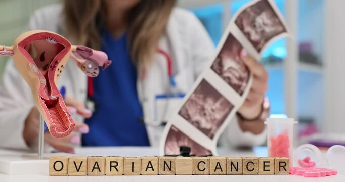 Woman gynecologist examines ultrasound images of uterus for signs of Ovarian Cancer. Doctor tries to identify possible abnormalities in hospital
