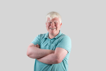 Portrait of smiling albino man isolated at grey background