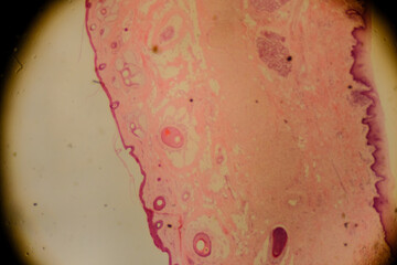 Human lip cross section showing epidermal and glandular structure