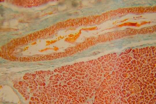 Human pancreas stained section showing acini and islets of Langerhan