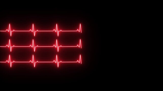 Neon glowing Cardiogram icon. Graphic representation of the work of the heart on a black background. Medical cardiogram. Electrocardiogram.