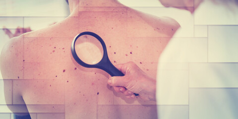 Dermatologist examining the skin of a patient, geometric pattern