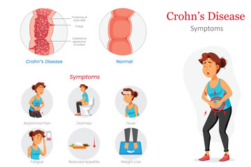 Crohns Disease Diagram Showing Symptoms and Abdominal Pain Example