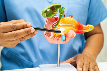 Pancreatitis, pancreatic cancer, Asian doctor with pancreas, gallbladder and bile duct human...