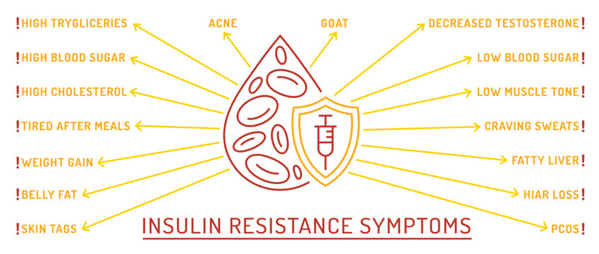 Insulin resistance symptoms infographic. Health warning on blood sugar imbalance