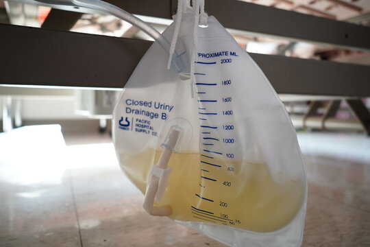 Urine bag.
