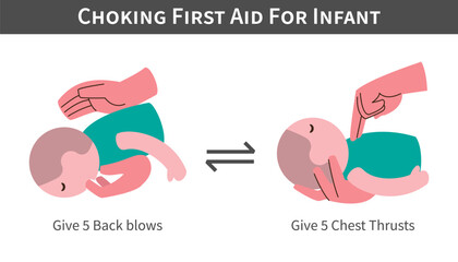 Choking First Aid For Infant cartoon illustration . Back blows and switch with chest thrusts . Flat design . Vector .