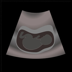 Ultrasound picture of fetus, vector illustration