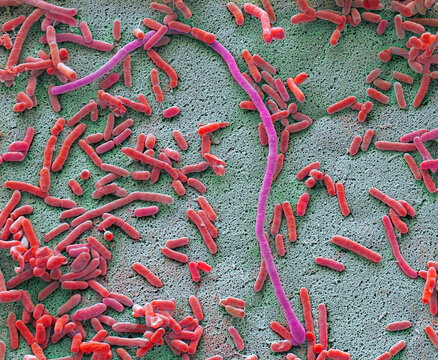 Dishcloth bacteria, SEM