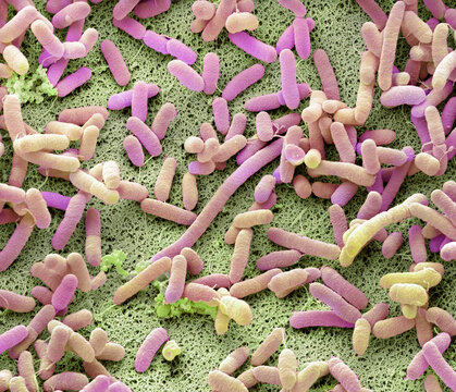 Dishcloth bacteria, SEM