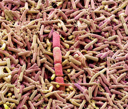 Compost bacteria, SEM