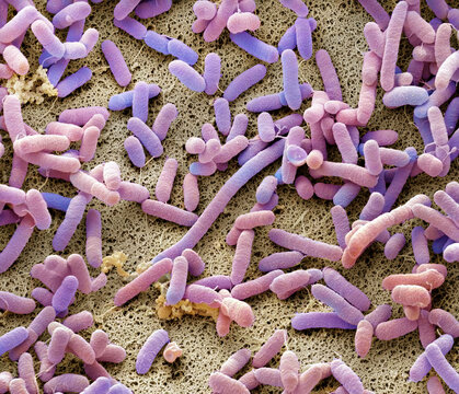 Dishcloth bacteria, SEM