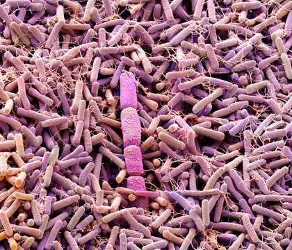 Compost bacteria, SEM