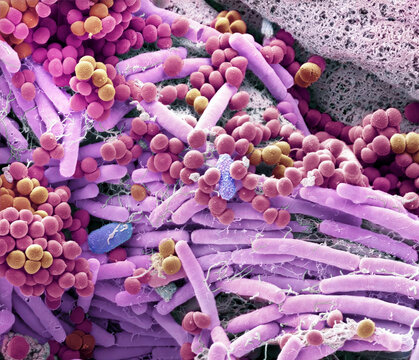 Skin bacteria, SEM