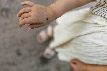 A close-up photo of a ladybug resting on a girl's hand © Natallia