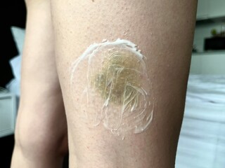 Fototapeta premium Close-Up of Bruised Woman's Leg — Gender Violence Awareness Concept