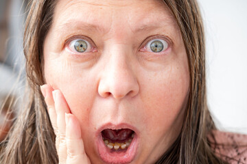 Amazed woman stares in shock, eyes wide open, bulging eyes, expressing disbelief and unexpected news, human emotion
